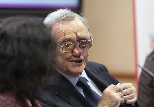 حملة جمع تبرعات أطلقت لدعم الإنجازات الإسبانية في أبحاث سرطان البنكرياس